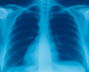 Medical Icons4 lungs.jpg (7559 bytes)